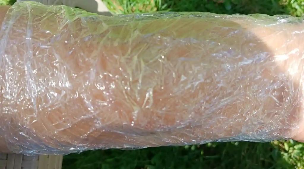 Kittlova mast -zábal na koleno